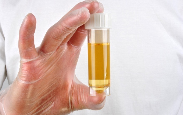 尿檢能檢測出來什么問題? 尿檢能檢測出來什么問題?